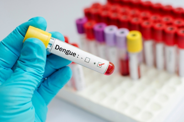 Dengue: uno studio spiega come avviene il contagio in Italia